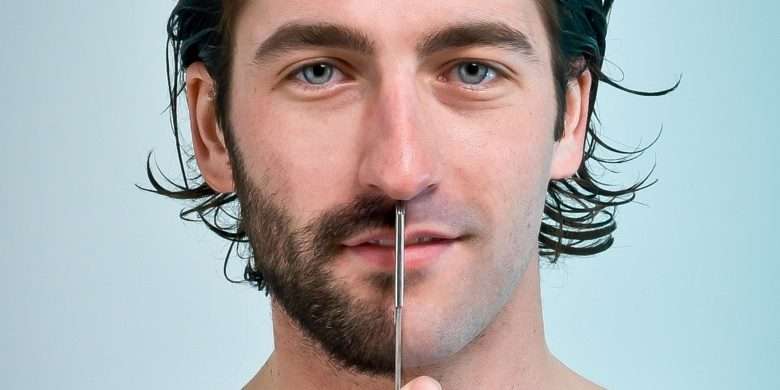 Последствия от пересадки волос на бороду
