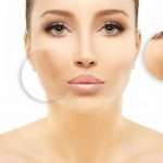 Лазерное удаление пигментных пятен на лице: назначение, особенности прохождения процедуры и отзывы